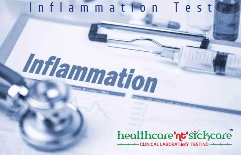 What is Inflammation? Inflammation Types, Causes, Symptoms, Effects And Diagnosis