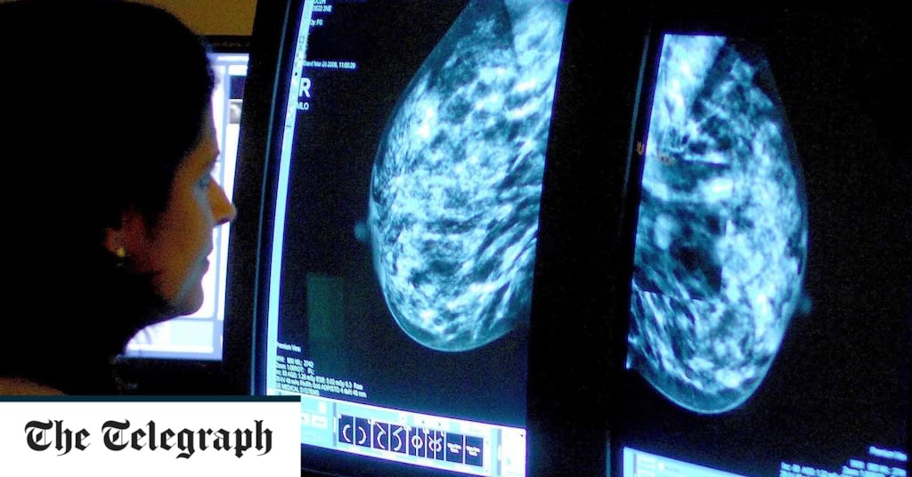 One in four cancer patients suffers delays being diagnosed, study finds