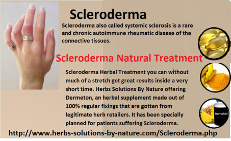 8 Natural Treatments for Scleroderma - Herbs Solutions By Nature