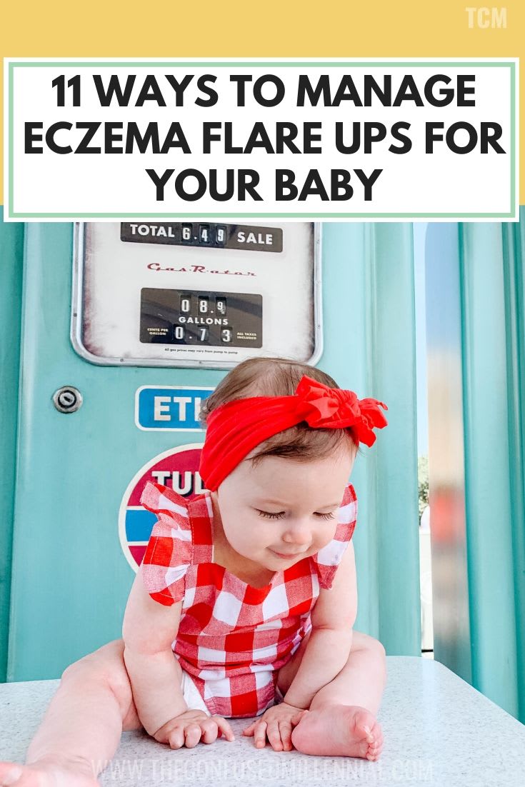 11 Ways To Manage Eczema Flare Ups For Your Baby