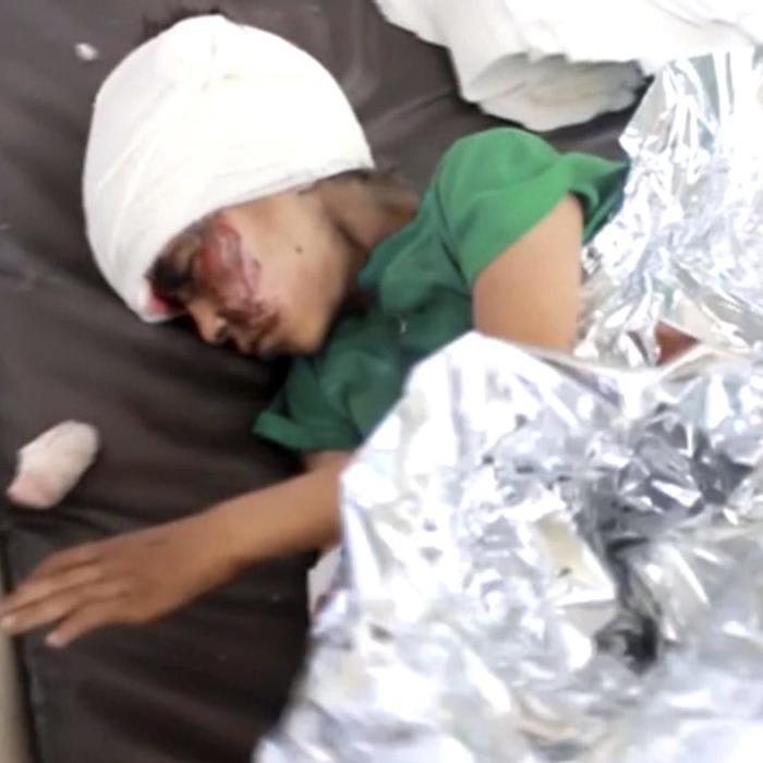 I don’t remember voting for U.S. bombs to murder little kids in Yemen, do you? | Will Bunch