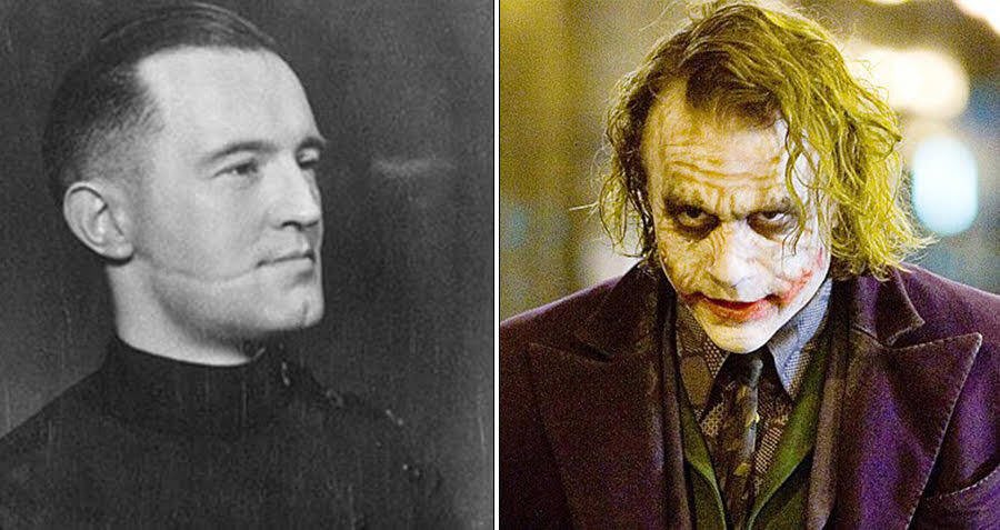 How A Torture Method Used By Scottish Gangs Inspired The Terrifying Scars On The Joker