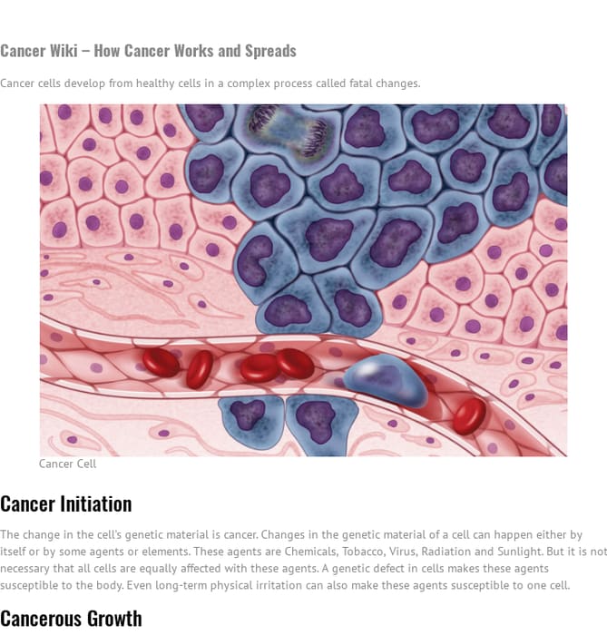 Cancer Wiki Guide Extensive Information about Cancer