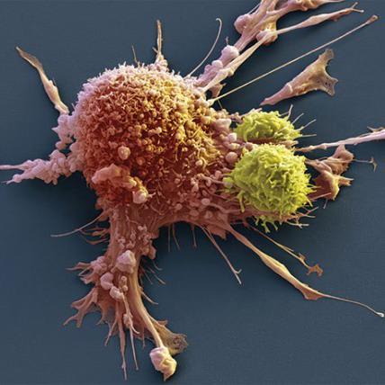 New Way To Manipulate Immune Cells May Treat Cancer, Autoimmune Disease