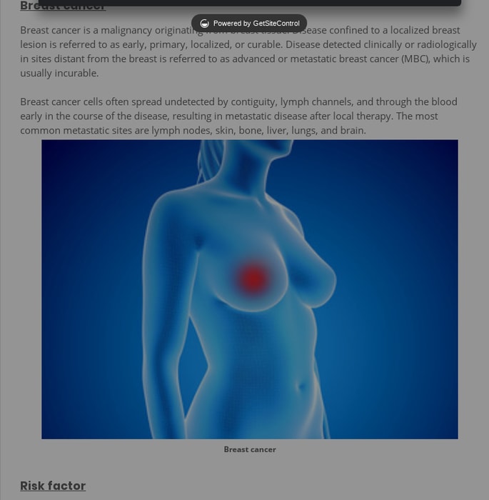 Breast cancer: risk factor, sign&symptoms, daignosis, stages,pathophysiology, treatment