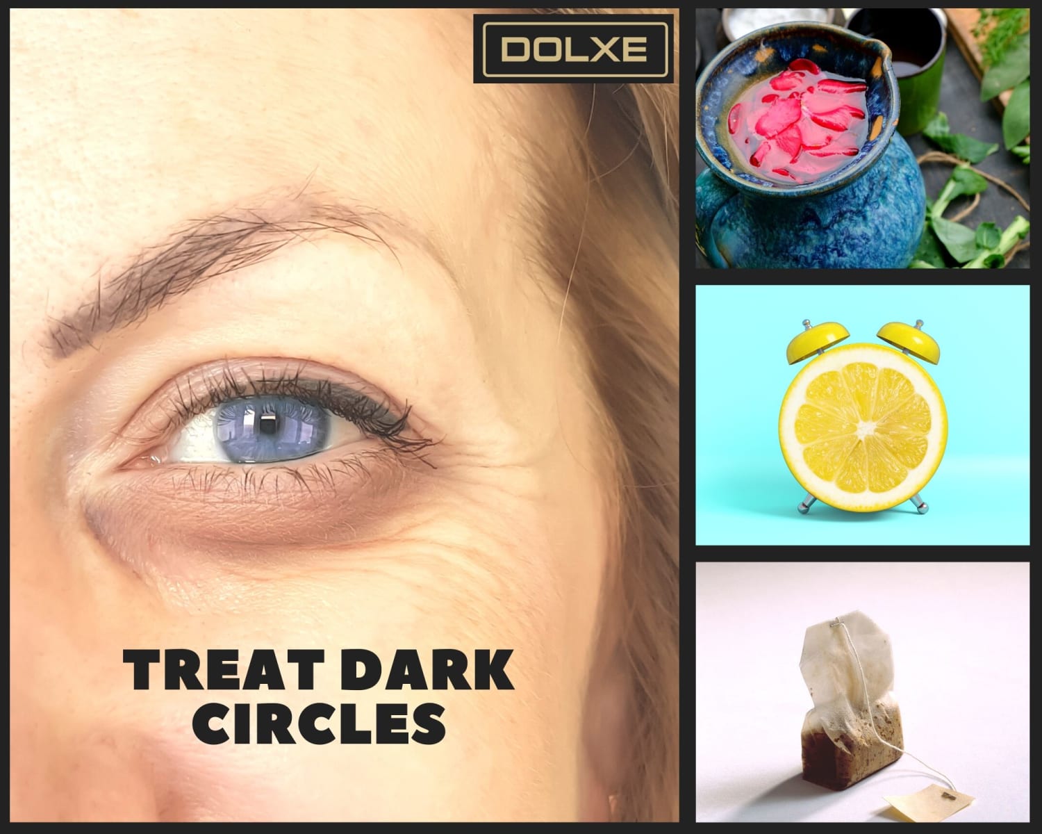 10 home remedies to treat dark circles overnight