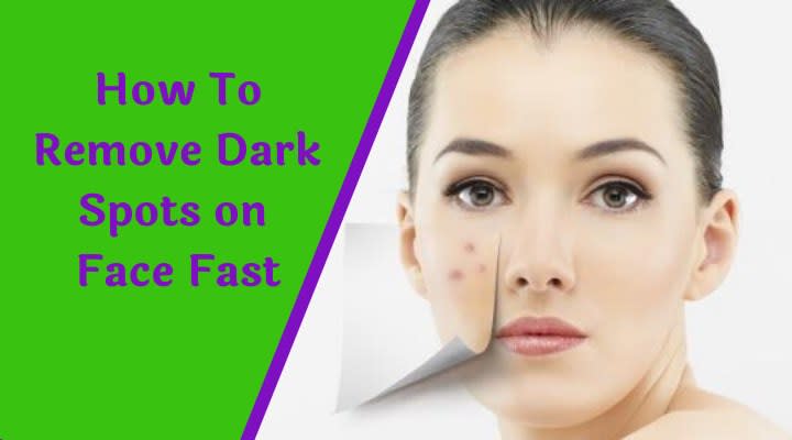 How to Remove Dark Spots on Face Fast - Daily Health Tips