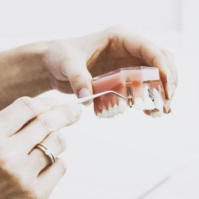 Dental Treatment Consumables Market is estimated to hit $41.06 billion by 2023