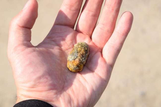 Scientists Just Solved a Mystery of How Gallstones Form
