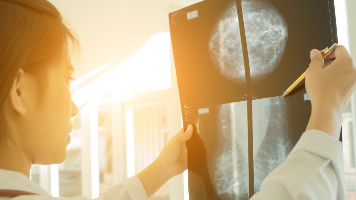 What Happens During a Mammogram and How to Make It More Bearable