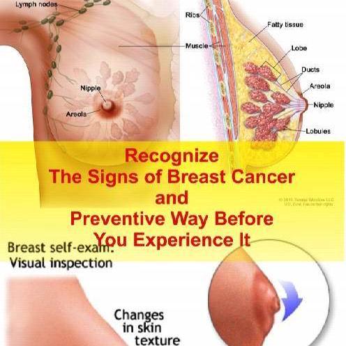 Signs Of Breast Cancer And The Way Of Prevention - Health and Beauty