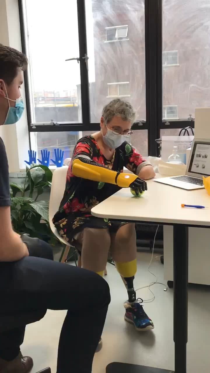 Caroline survived COVID, Kidney failure, Sepsis, and a quadruple amputation. See her joy using her new bionic hand for the first time. :)