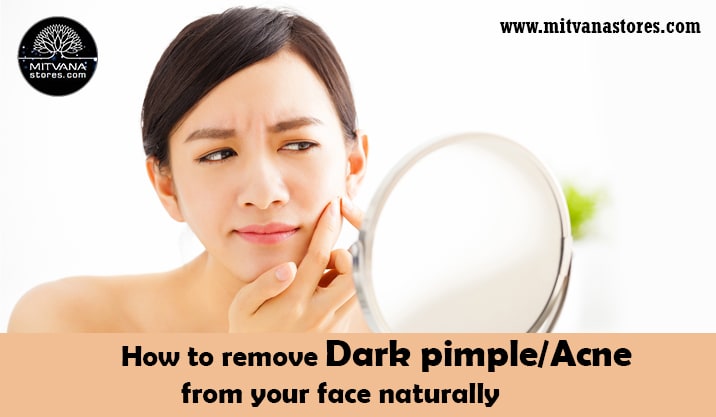 How to remove dark pimple or Acne from your face naturally.
