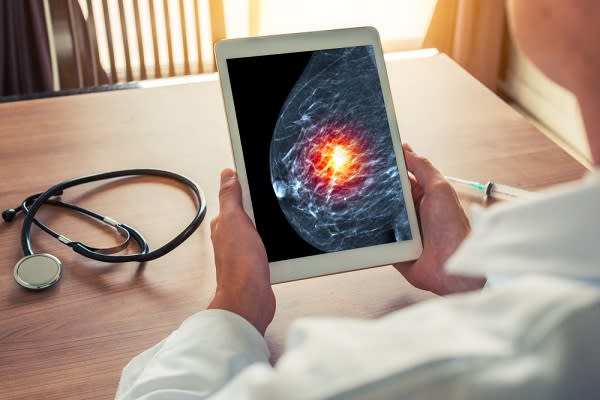 Google Develops AI That Detects Breast Cancer With Greater Accuracy Than Experts