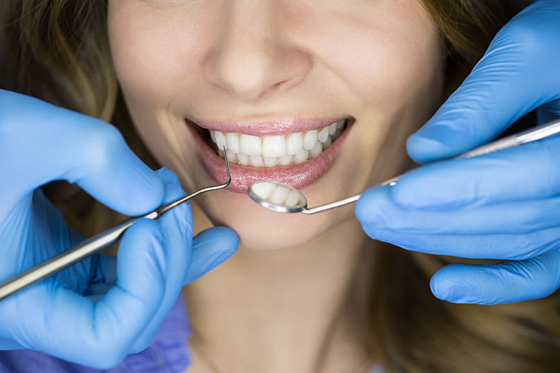 How Often Do You Need a Hygiene Treatment? - Sutherland Shire Dentist