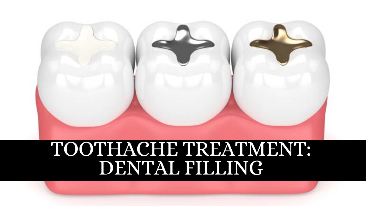 Toothache: Dental Filling. Gold, Amalgam, Composite, Ceramic, Cavity