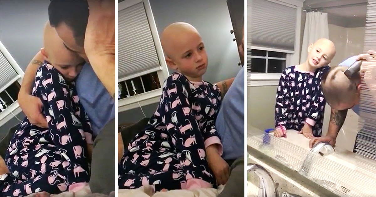When A Girl With Alopecia Says She Doesn't Love Herself, Her Dad Shaves His Head To Prove She Should