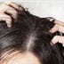 HOME REMEDIES TO GET RID OF DANDRUFF