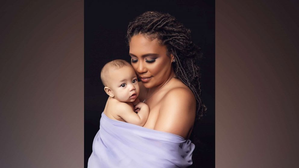Healthcare worker mom shares powerful breastfeeding photo to empower others