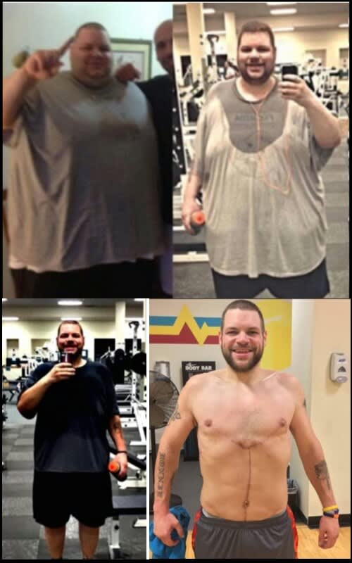 Roonie Brower lost over 400 pounds (181 kg) continuing to shed off the weight. Brower was determined to get in shape after doctors warned him about his serious health risks since he was close to 700 pounds (317 kg).