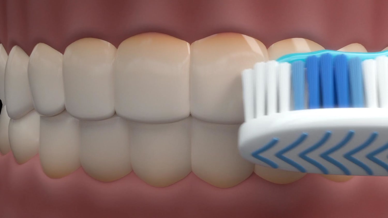 Plaque Identifying Toothpaste May Prevent Heart Attacks and Strokes ..