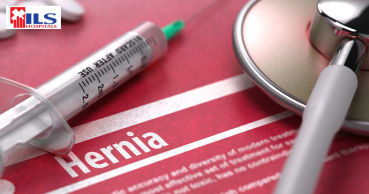 Acquaint Yourself With These 4 Different Types Of Hernia