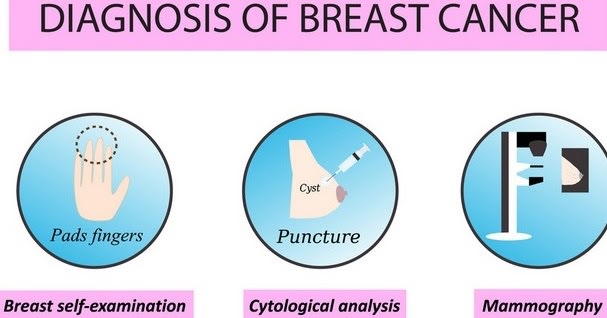 Several Methods to Conduct Breast Cancer Diagnosis