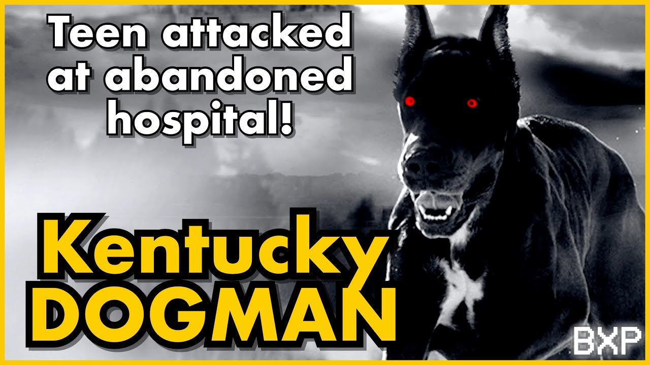 Do Dogmen attack humans? This young man has the scars and reports to prove, yes they do! | BXP A030