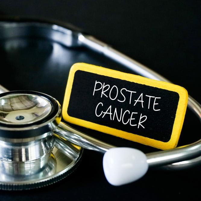 Tips to Prevent Being Diagnosed with Prostate Cancer