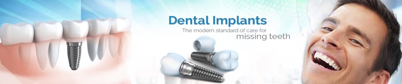 Full mouth dental implants Clinic in Mohali and Chandigarh
