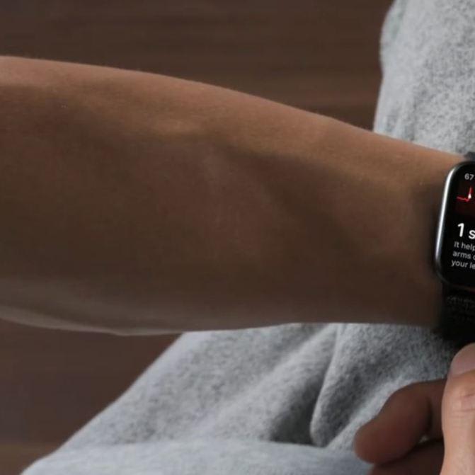 Johnson & Johnson partners with Apple to see if Watch can prevent strokes