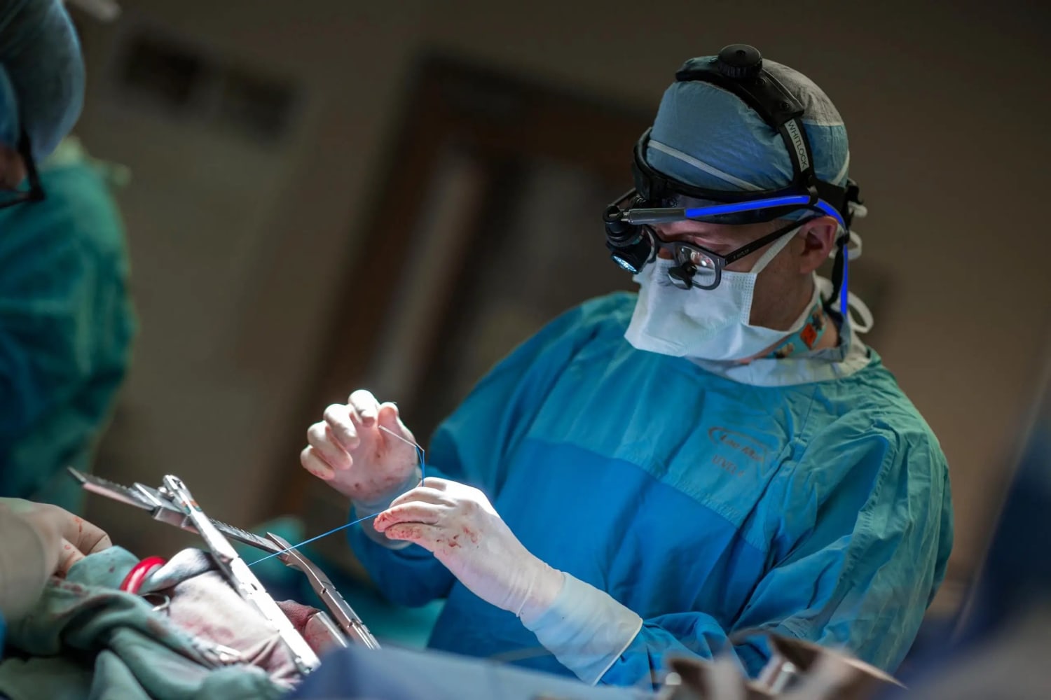 Simple Surgery Prevents Strokes in Heart Patients