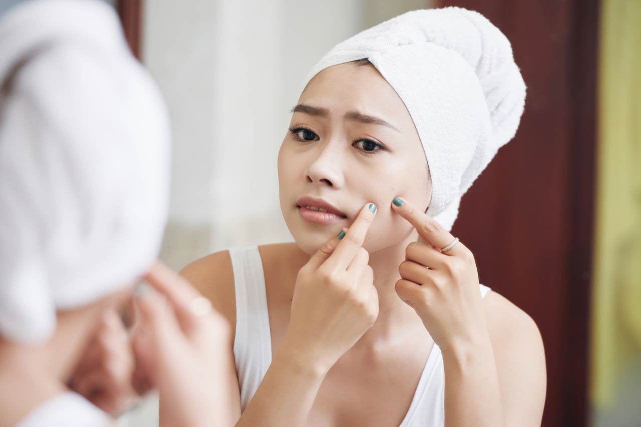 Acne care tips for teenagers