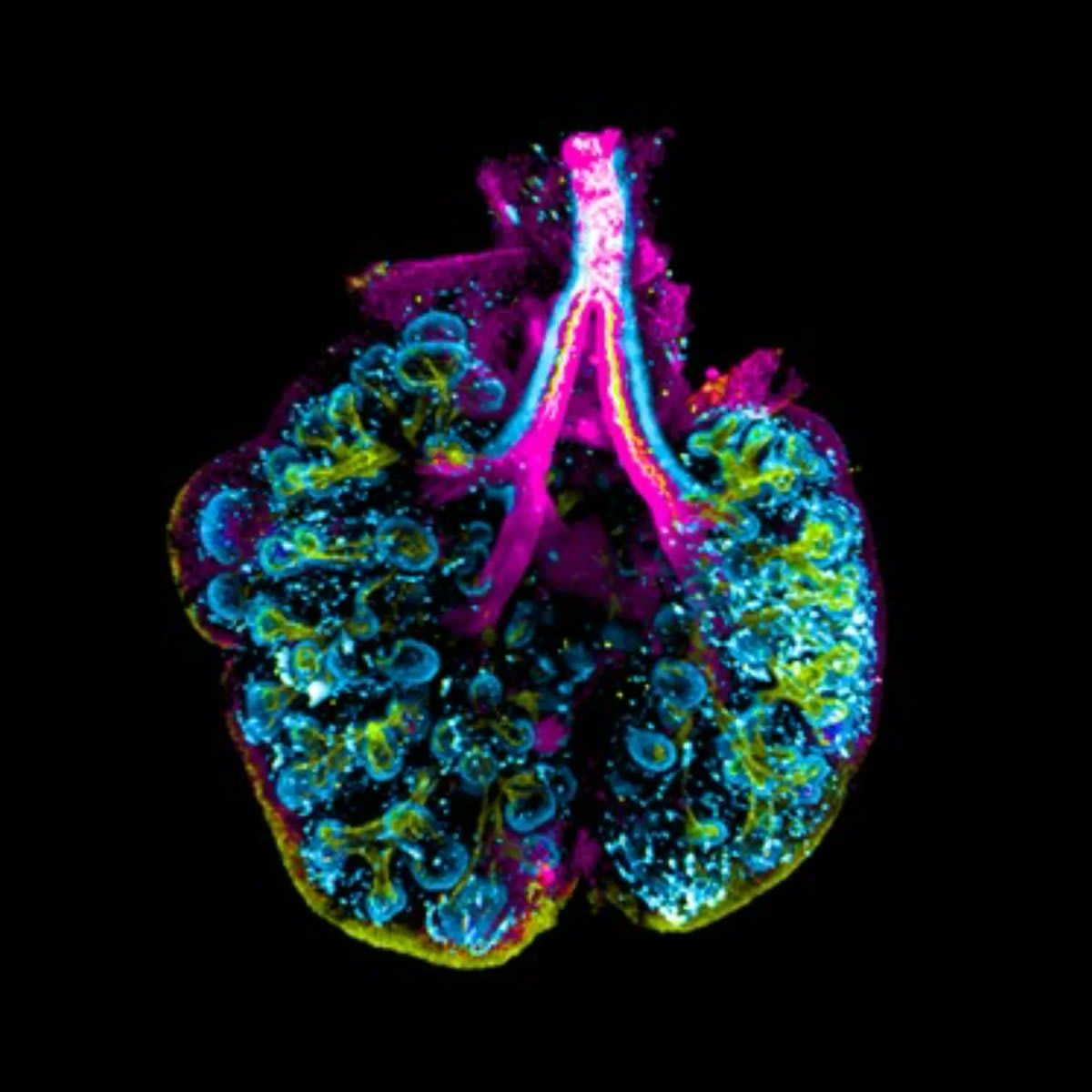 Staining lab-grown, developing lung tissue reveals the different types of stem cells composing it. These cells eventually divide into different tissues that compose our complex airways. Visualizing them allows researchers to map how lungs grow. 📷 Casey Ah-Cann/@wehi_research