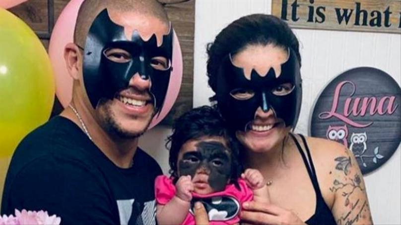 Parents Wear 'Batman Mask' In Solidarity With Their Little Girl Who Has A Rare Skin Condition