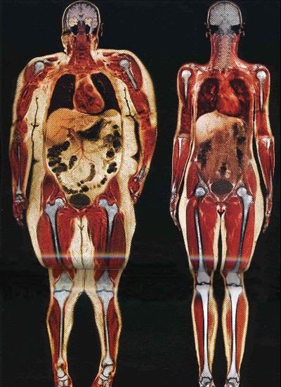 Body scan of 250lb and 120lb woman side by side. (Airport scanners not expected to be this detailed)