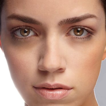 How To Get Rid Of The Dark Eye Bags!