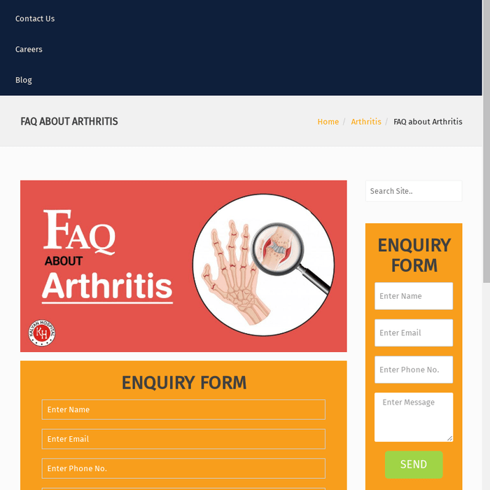 FAQ about Arthritis