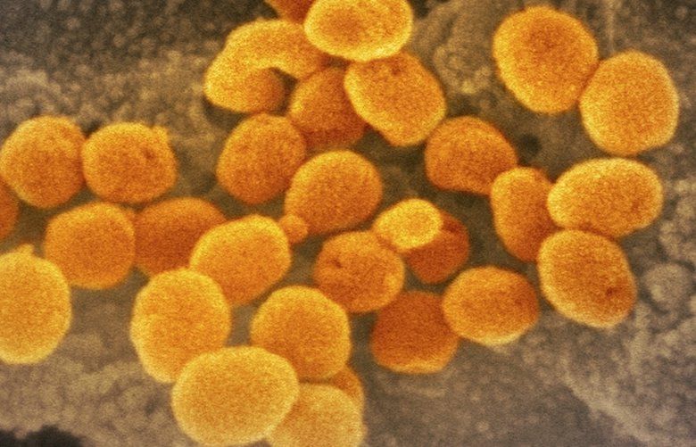 Gates-funded program will soon offer home-testing kits for new coronavirus