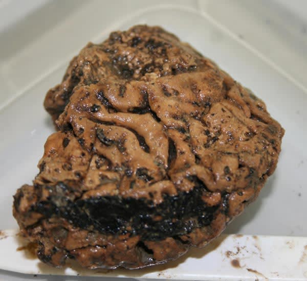 2,500-Year-Old Preserved Human Brain Discovered