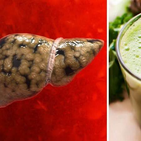 Cleanse the Liver While Burning Belly Fat - Health and Beauty