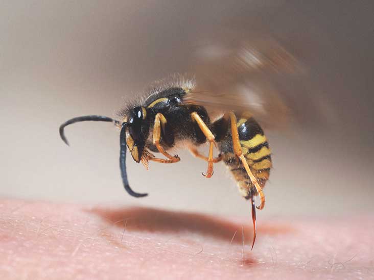 Yellow Jacket Stings: Symptoms, Treatment, and How to Avoid Them