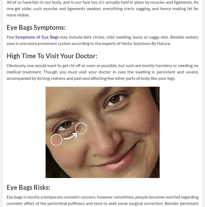 Eye Bags- Mid Swelling Under Your Eyes - Herbs Solutions By Nature
