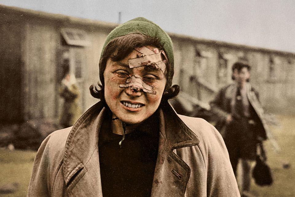 A colorized photo of a woman after she is liberated from Bergen Belsen concentration camp by the British, April 1945.