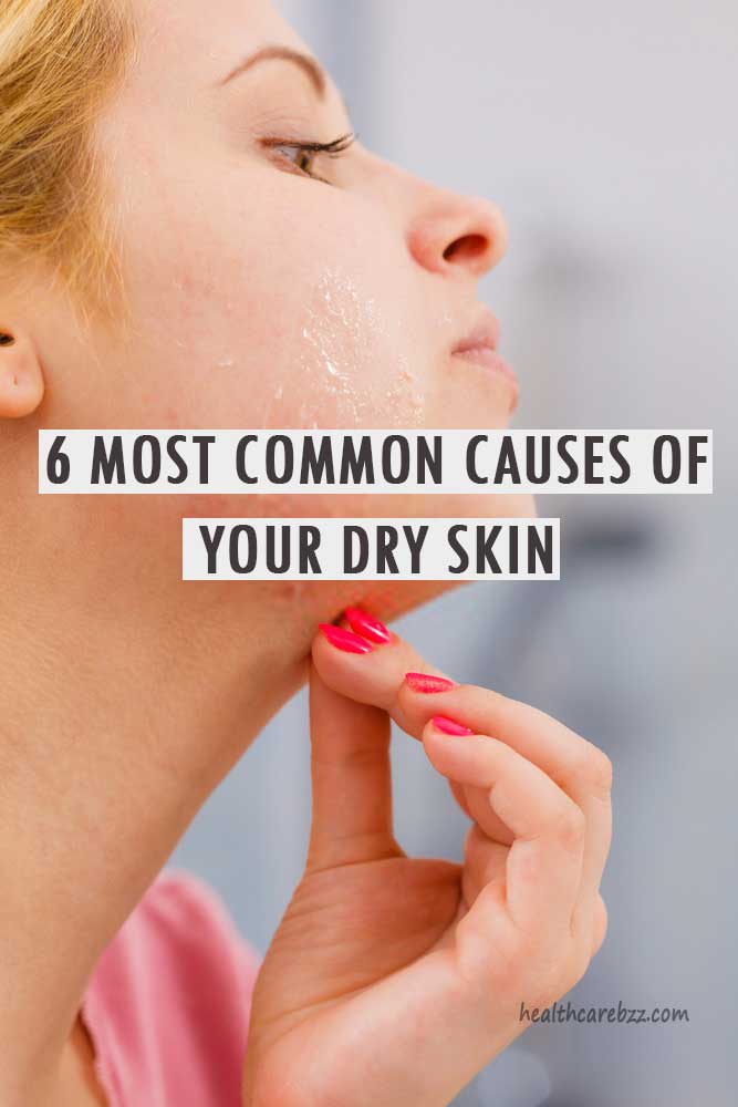 6 Most Common Causes Of Your Dry Skin - Healthcare