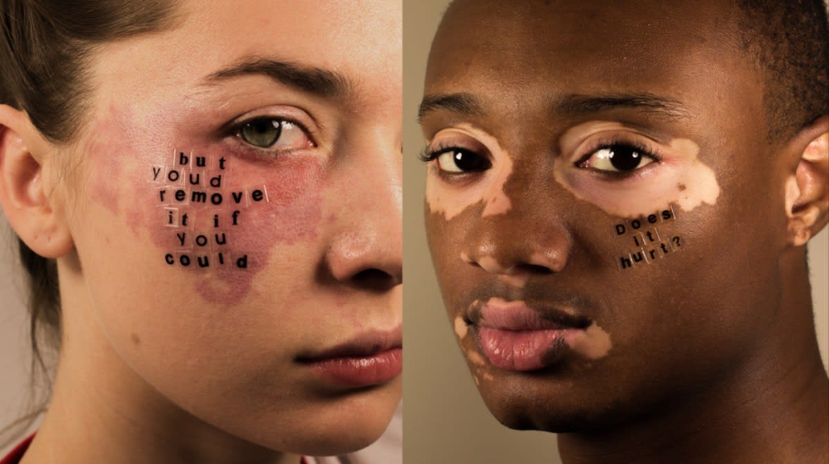 Peter DeVito's skin conditions project is absolutely beautiful
