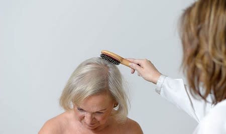 Lifestyle and Health, Cure Hair Loss in Women Over 40