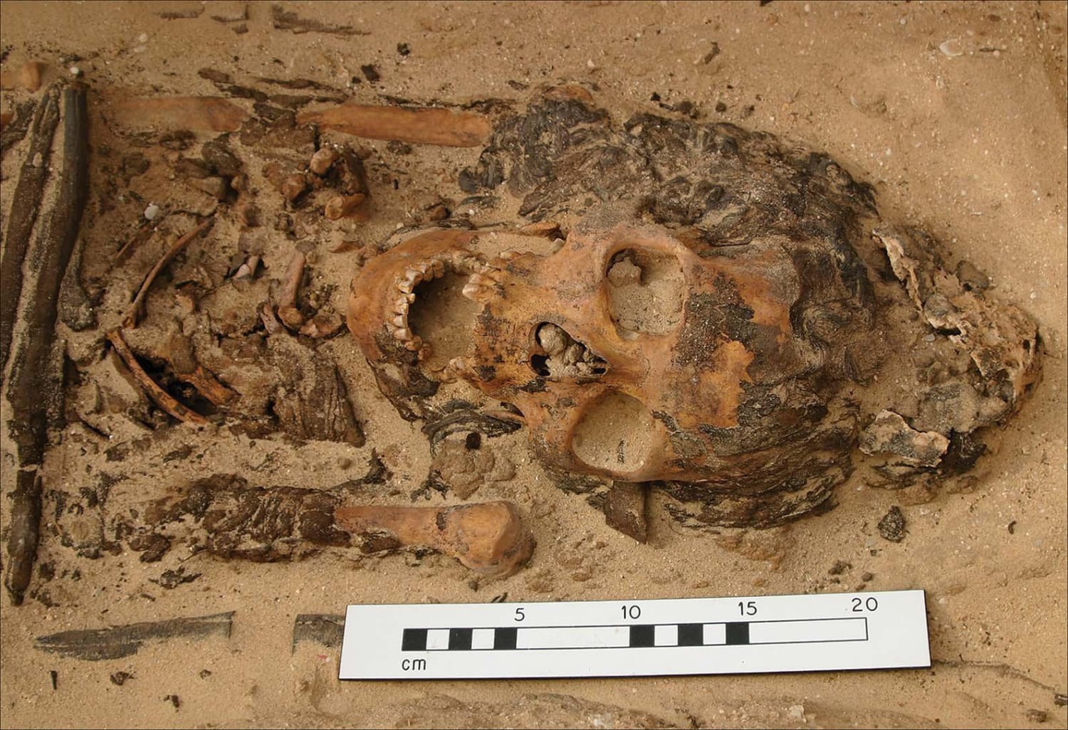 Ancient Egyptian Head Cones Were Real, Grave Excavations Suggest