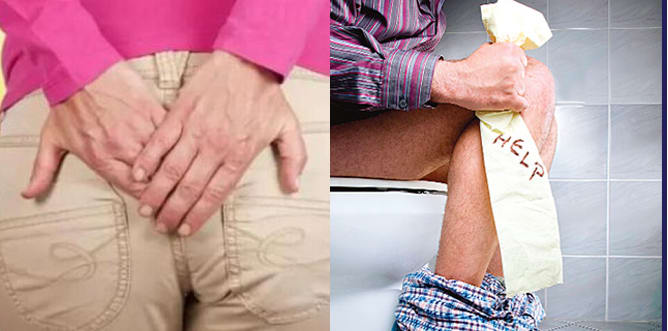 What is Piles Causes and treatment of Hemorrhoids: vedas cure
