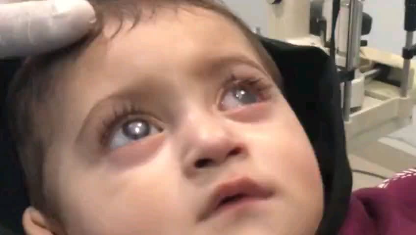 This incredible video of a 15 month old baby seeing his father for the very first time after a corneal transplant. The doctors and staff at the Pakistan Eye Bank Society in Karachi are doing some incredible work.